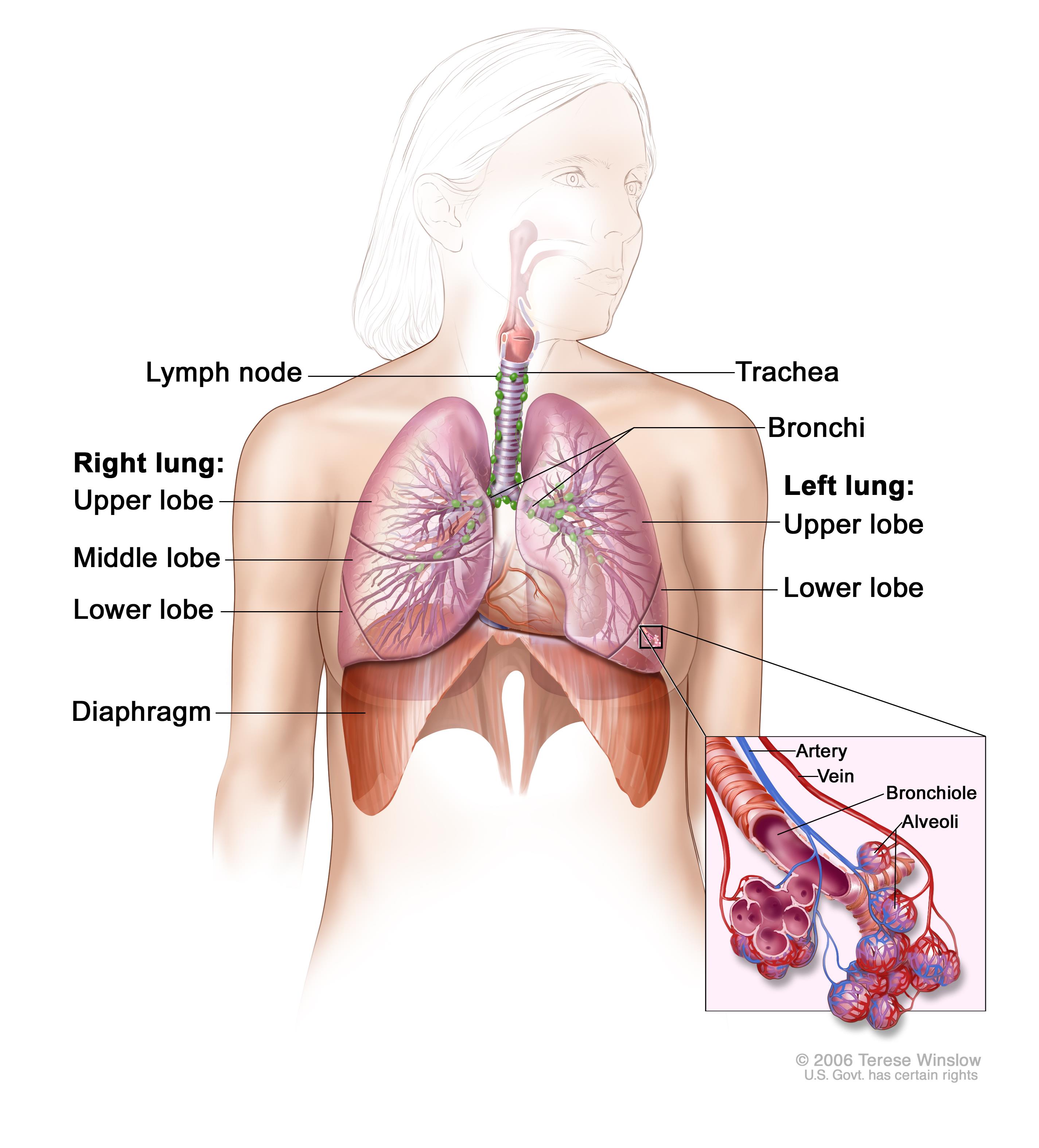 PIN REMOVED FROM A TEENAGERS LUNG