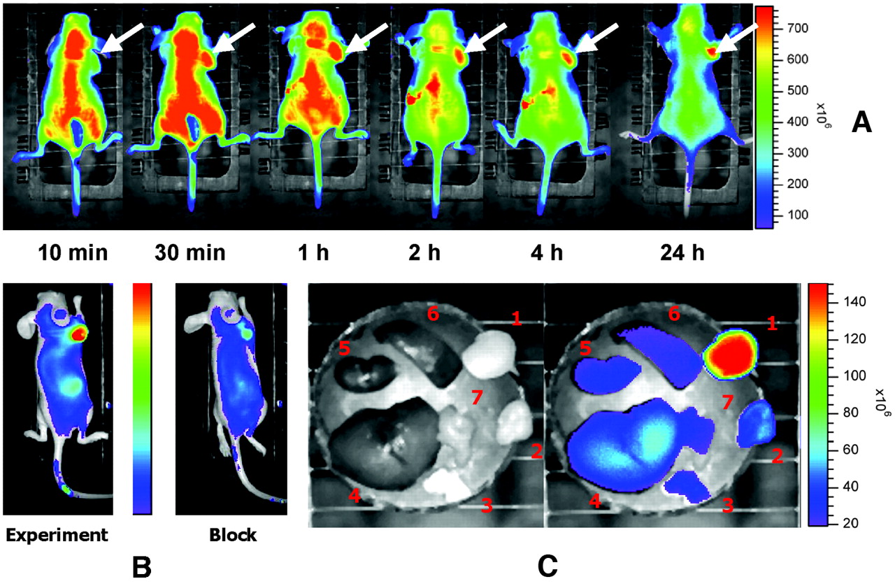 Optical imaging