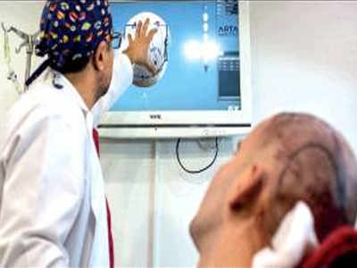 hair-transplant-death