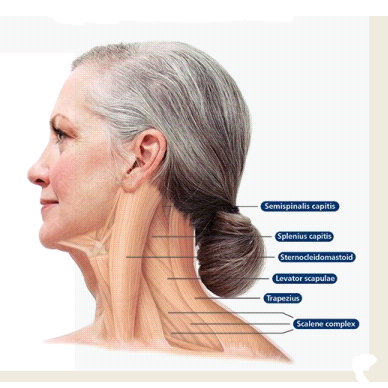DYSTONIA
